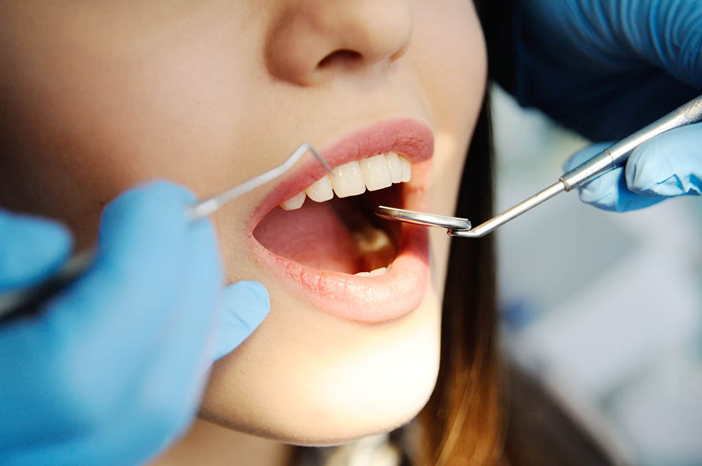 Cure e ricostruzioni dentali