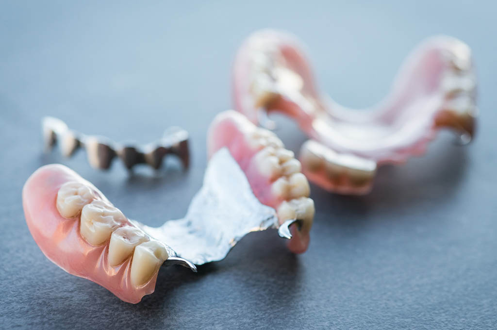 Protesi e impianti ortodontici